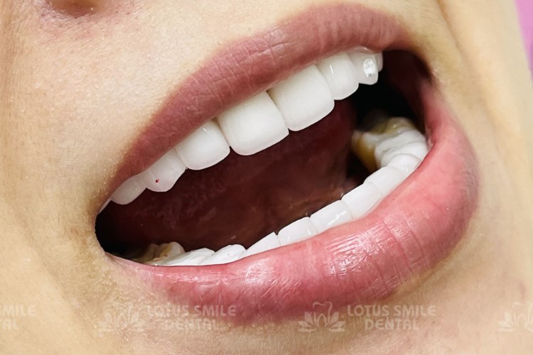 Lotus Smile Dental